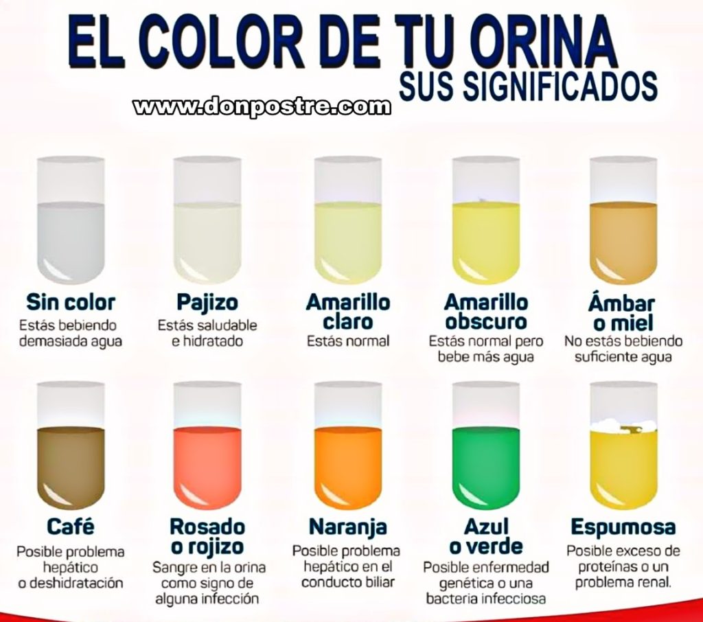 Don Postre » significado del color de la orina